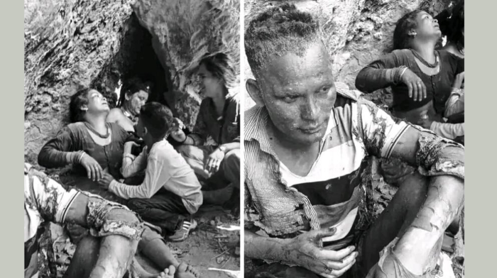 दैलेखमा १२ जना मजदुर आगोले जलेर घाइते