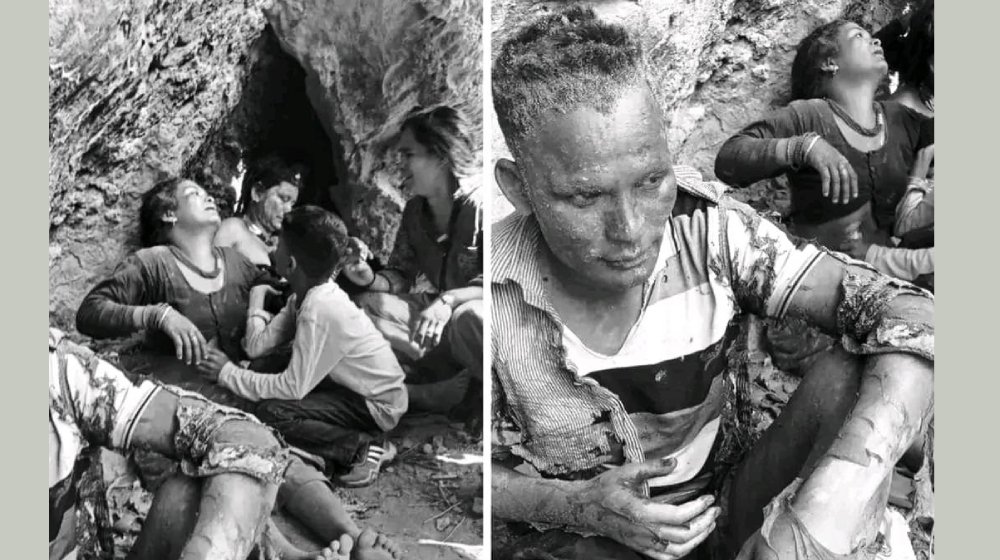 दैलेखमा १२ जना मजदुर आगोले जलेर घाइते