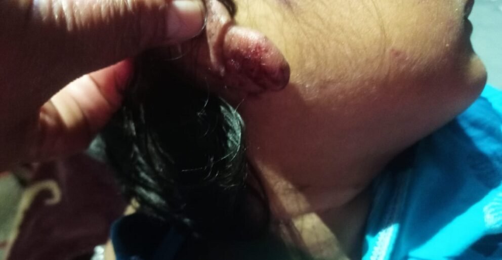 नपढेको भन्दै ४ वर्षकी छोरीलाई चरम यातना, २७ वर्षीय बाबु पक्राउ